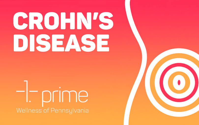 PA Qualifying Conditions: Crohn’s Disease